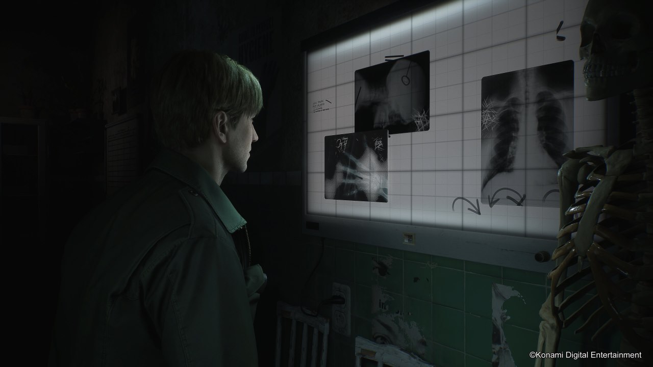 Danh sách cúp làm lại Silent Hill 2